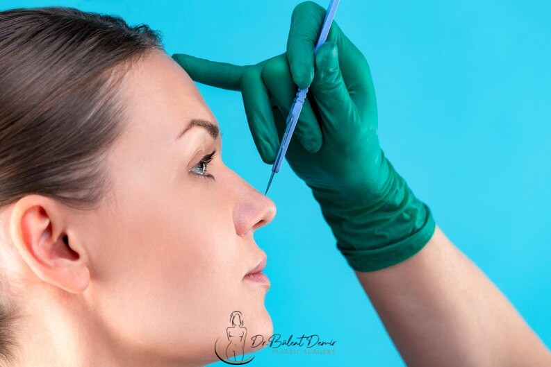 Rhinoplasty (Nose Job, Nose Aesthetics )- Nose Job Cost in Turkey